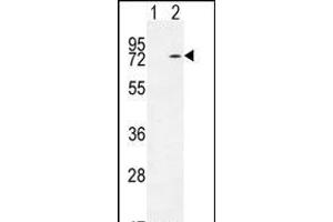 Western blot analysis of KARS (arrow) using rabbit polyclonal KARS Antibody (N-term) (ABIN655049 and ABIN2844677). (KARS Antikörper  (N-Term))