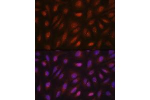 Immunofluorescence analysis of U2OS cells using CETN3 antibody (ABIN7268452) at dilution of 1:100. (CETN3 Antikörper  (AA 1-167))