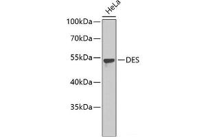 Western blot analysis of extracts of HeLa cells using DES Polyclonal Antibody. (Desmin Antikörper)