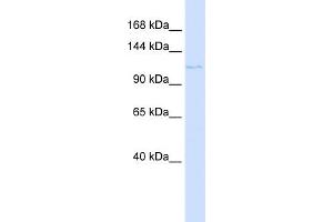 WB Suggested Anti-PTCH2 Antibody Titration:  0. (Patched 2 Antikörper  (N-Term))