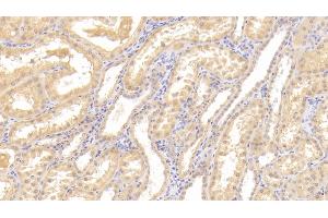 Detection of Tie1 in Human Kidney Tissue using Polyclonal Antibody to Tyrosine Kinase With Immunoglobulin Like And EGF Like Domains Protein 1 (Tie1) (TIE1 Antikörper  (AA 435-609))