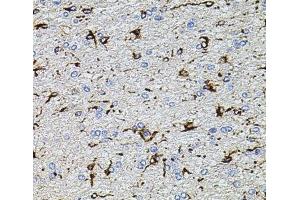 Immunohistochemistry of paraffin-embedded Rat brain using TRPA1 Polyclonal Antibody at dilution of 1:100 (40x lens). (TRPA1 Antikörper)