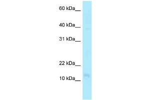 WB Suggested Anti-PFDN4 Antibody Titration: 1. (PFDN4 Antikörper  (N-Term))