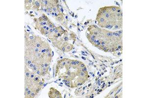 Immunohistochemistry of paraffin-embedded human stomach using NDUFA6 antibody (ABIN6003563) at dilution of 1/100 (40x lens). (NDUFA6 Antikörper)