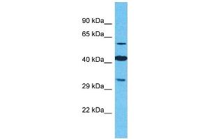 Western Blotting (WB) image for anti-Olfactory Receptor, Family 2, Subfamily M, Member 4 (OR2M4) (C-Term) antibody (ABIN2791726) (OR2M4 Antikörper  (C-Term))