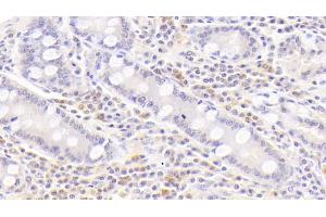 Detection of BAFFR in Human Small intestine Tissue using Polyclonal Antibody to B-Cell Activation Factor Receptor (BAFFR) (BAFF Antikörper  (AA 96-184))
