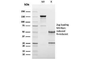 SDS-PAGE Analysis Purified CD19 Monospecific Mouse Monoclonal Antibody (CD19/3117). (CD19 Antikörper  (AA 96-281))