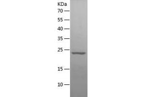 Western Blotting (WB) image for Interleukin 6 (IL6) (AA 47-241) protein (His tag) (ABIN7123604) (IL-6 Protein (AA 47-241) (His tag))