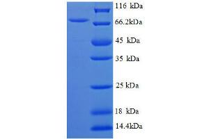 SDS-PAGE (SDS) image for Biosynthetic Arginine Decarboxylase (AA 3-656), (partial) protein (His tag) (ABIN1046620)