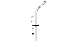 Western Blot at 1:8000 dilution + human skeletal muscle lysate Lysates/proteins at 20 ug per lane. (PYGM Antikörper  (C-Term))