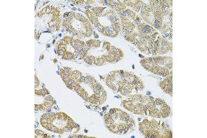 Immunohistochemistry of paraffin-embedded human stomach using VEPH1 antibody (ABIN5974616) (40x lens). (VEPH1 Antikörper)