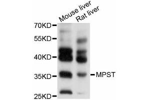 Western blot analysis of extracts of various cell lines, using MPST antibody (ABIN5998252) at 1/1000 dilution. (MPST Antikörper)
