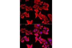 Immunofluorescence analysis of U2OS cells using THRSP antibody (ABIN5974357). (THRSP Antikörper)
