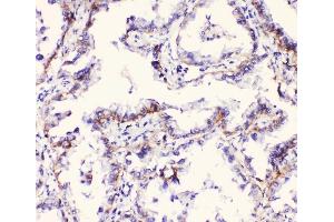 IHC analysis of Integrin alpha 3 using anti-Integrin alpha 3 antibody (ABIN6719410). (ITGA3 Antikörper)