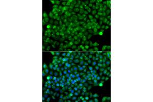 Immunofluorescence analysis of A549 cells using CFHR3 antibody (ABIN6294036). (CFHR3 Antikörper)