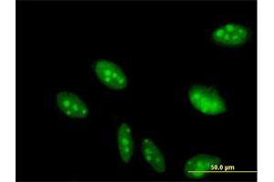 Immunofluorescence of purified MaxPab antibody to C2orf3 on HeLa cell.
