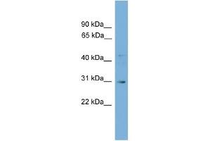 WB Suggested Anti-Gje1 Antibody Titration: 0. (GJE1 Antikörper  (N-Term))