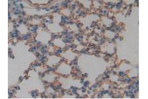 IHC-P analysis of Mouse Lung Tissue, with DAB staining. (Thrombomodulin Antikörper  (AA 31-167))