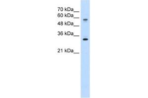 Western Blotting (WB) image for anti-Solute Carrier Family 22 (Organic Cation Transporter), Member 1 (SLC22A1) antibody (ABIN2462442) (SLC22A1 Antikörper)