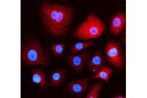 IF analysis of EEA1 using anti- EEA1 antibody (ABIN5692856). (EEA1 Antikörper)
