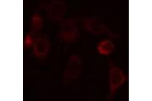 ABIN6274130 staining 293 cells by IF/ICC. (DGKI Antikörper  (C-Term))
