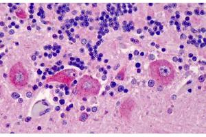 Human  Brain, Cerebellum: Formalin-Fixed, Paraffin-Embedded (FFPE) (GPR77 Antikörper  (AA 1-50))