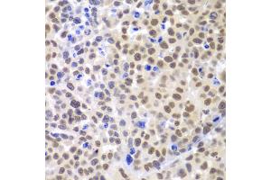 Immunohistochemistry of paraffin-embedded mouse cancer using LHX4 antibody.