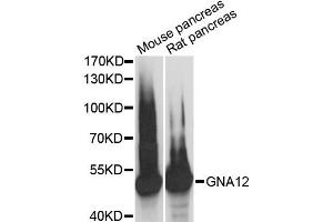 Western blot analysis of extracts of various cell lines, using GNA12 antibody (ABIN6292955) at 1:3000 dilution.