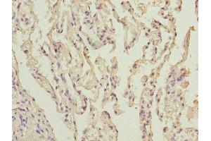 Immunohistochemistry of paraffin-embedded human lung tissue using ABIN7170967 at dilution of 1:100 (UBE2I Antikörper  (AA 1-157))