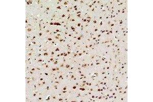 Immunohistochemical analysis of NF-kappaB p65 staining in rat brain  formalin fixed paraffin embedded tissue section. (NF-kB p65 Antikörper)