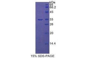 SDS-PAGE (SDS) image for Chitinase 3-Like 1 (Cartilage Glycoprotein-39) (CHI3L1) (AA 112-377) protein (His tag) (ABIN1879780)