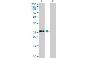 METTL6 Antikörper  (AA 1-255)