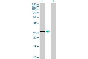 Western Blot analysis of METTL6 expression in transfected 293T cell line by METTL6 MaxPab polyclonal antibody. (METTL6 Antikörper  (AA 1-255))