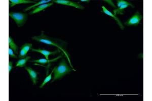 Immunofluorescence of purified MaxPab antibody to PARK7 on HeLa cell. (PARK7/DJ1 Antikörper  (AA 1-189))