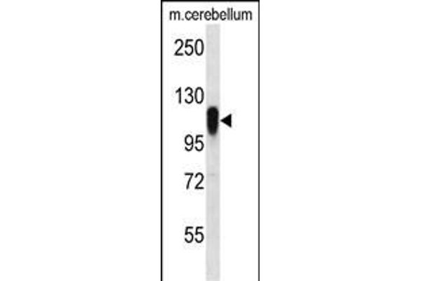 FBXO41 Antikörper  (N-Term)