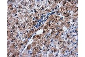 Immunohistochemical staining of paraffin-embedded liver tissue using anti-PPME1mouse monoclonal antibody. (PPME1 Antikörper)
