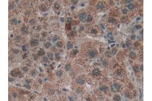Immunohistochemistry (IHC) image for anti-Lymphotoxin beta Receptor (TNFR Superfamily, Member 3) (LTBR) (AA 66-215) antibody (ABIN7437122)