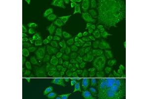 Immunofluorescence analysis of U2OS cells using FXR1 Polyclonal Antibody at dilution of 1:100. (FXR1 Antikörper)