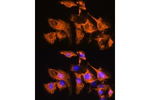 Immunofluorescence analysis of C6 cells using  Rabbit pAb (ABIN7265482) at dilution of 1:100. (ARF4 Antikörper  (AA 1-180))