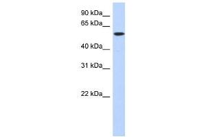 DNTT antibody used at 1 ug/ml to detect target protein. (TdT Antikörper  (Middle Region))