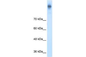 WB Suggested Anti-SLC12A2 Antibody Titration: 5. (SLC12A2 Antikörper  (C-Term))