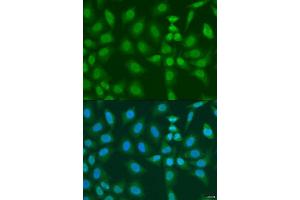 Immunofluorescence analysis of U2OS cells using PHF21B antibody. (PHF21B Antikörper  (AA 322-531))