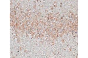 Immunohistochemistry of paraffin-embedded Rat brain using TMX1 Polyclonal Antibody at dilution of 1:100 (40x lens). (TMX1 Antikörper)