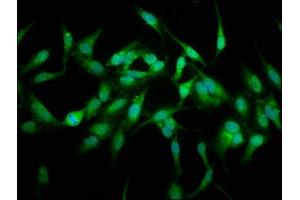 Immunofluorescence staining of Hela cells with ABIN7174344 at 1:66, counter-stained with DAPI.