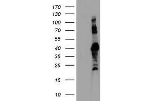 Western Blotting (WB) image for anti-Ring Finger Protein 113B (RNF113B) antibody (ABIN1500715) (RNF113B Antikörper)