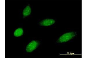 Immunofluorescence of purified MaxPab antibody to MMS19 on HeLa cell. (MMS19 Antikörper  (AA 1-293))