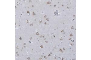 Immunohistochemical staining of human cerebral cortex with CCNJ polyclonal antibody  shows moderate cytoplasmic positivity in neuronal cells. (Cyclin J Antikörper)
