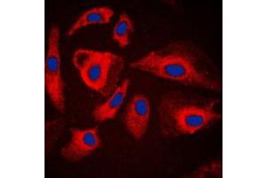Immunofluorescent analysis of HSPH1 staining in HeLa cells. (HSPH1 Antikörper  (C-Term))