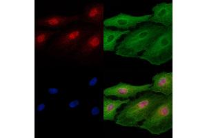 ABIN7094781 and ABIN7098832 staining  cells by IF/ICC. (FOXF2 Antikörper  (Internal Region))