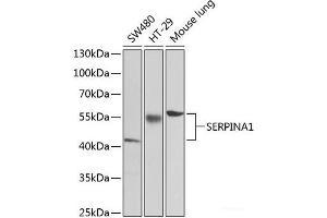 Western blot analysis of extracts of various cell lines using SERPINA1 Polyclonal Antibody at dilution of 1:1000. (SERPINA1 Antikörper)